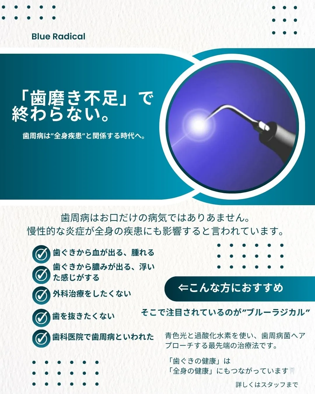 おちデンタルクリニック長久手ではブルーラジカル（Blue R...